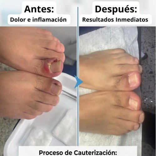 Antes y después: dolor e inflamación vs resultados inmediatos